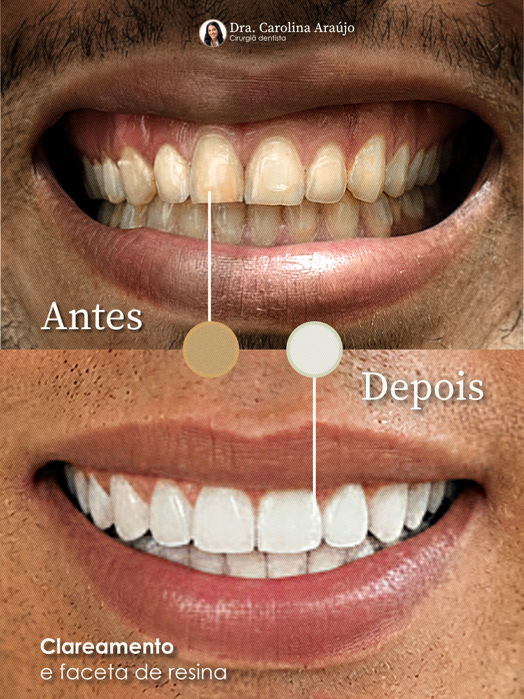 Post-antes-e-depois-vers-o-2.png